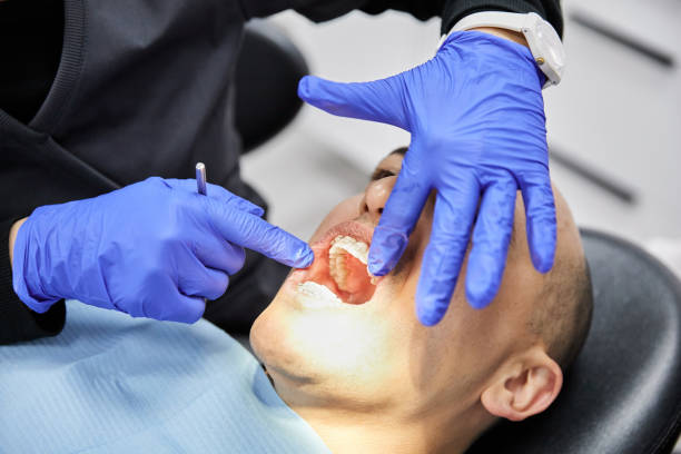 Best Broken or Cracked Tooth Emergency Dentist in Snyder, TX