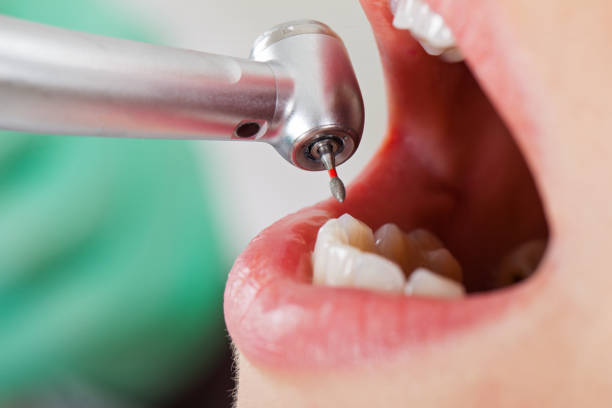 Best Mobile Emergency Dentist in Snyder, TX